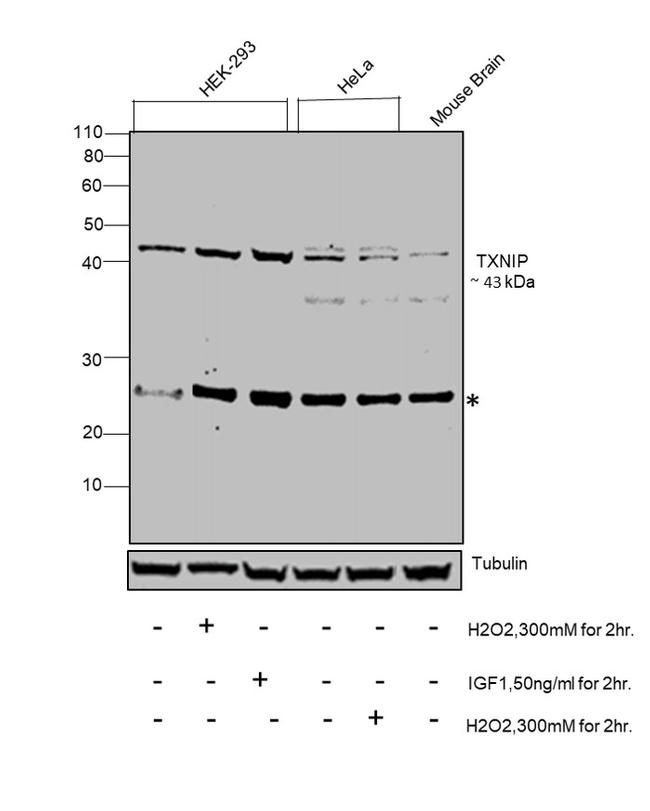 TXNIP Antibody in Western Blot (WB)