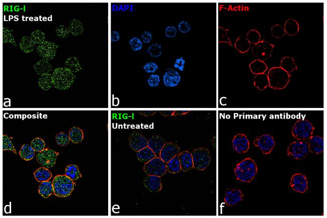 RIG-I Antibody in Immunocytochemistry (ICC/IF)