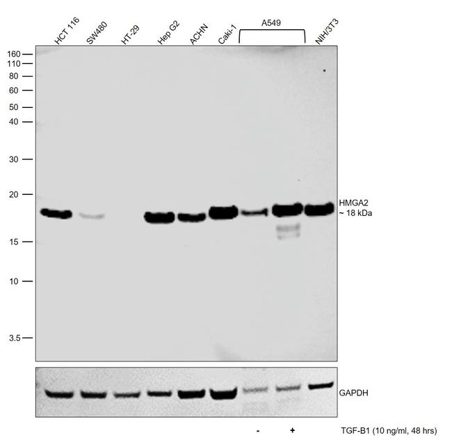 HMGA2 Antibody in Western Blot (WB)