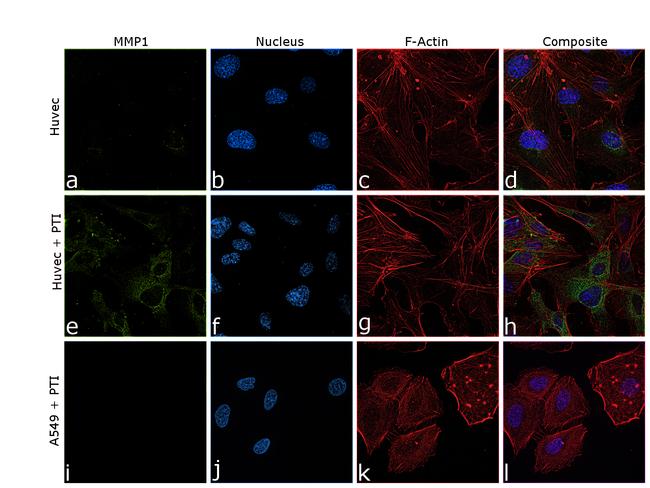 MMP1 Antibody in Immunocytochemistry (ICC/IF)