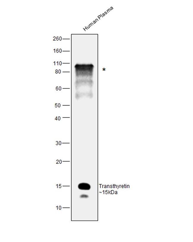 Transthyretin Antibody in Western Blot (WB)