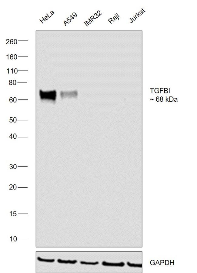 TGFBI Antibody in Western Blot (WB)