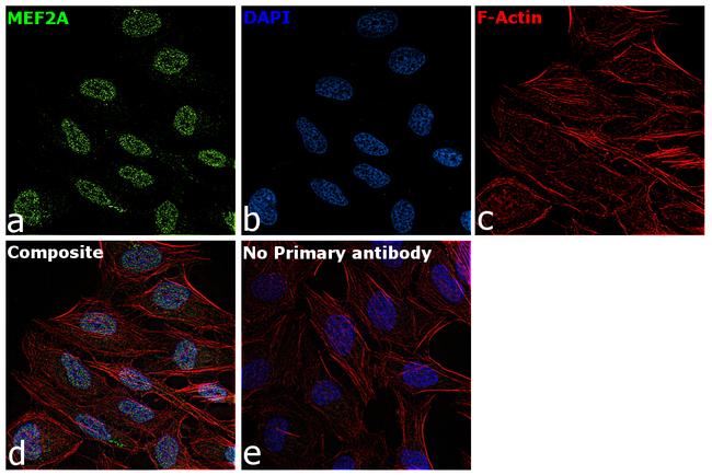 MEF2A Antibody in Immunocytochemistry (ICC/IF)