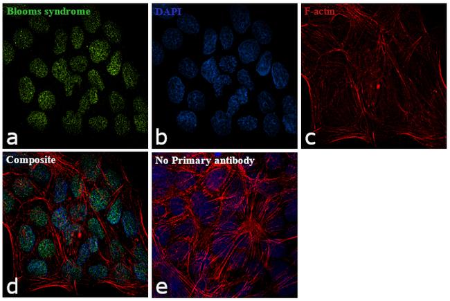 Blooms Syndrome Antibody in Immunocytochemistry (ICC/IF)