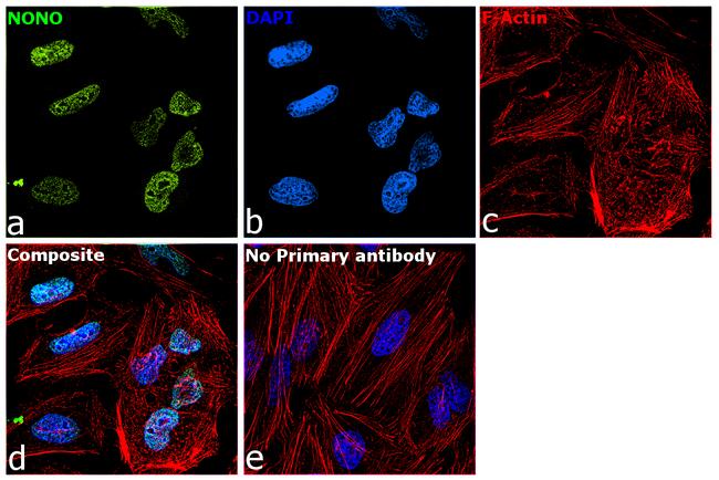 NONO Antibody in Immunocytochemistry (ICC/IF)