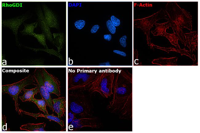 RhoGDI Antibody in Immunocytochemistry (ICC/IF)