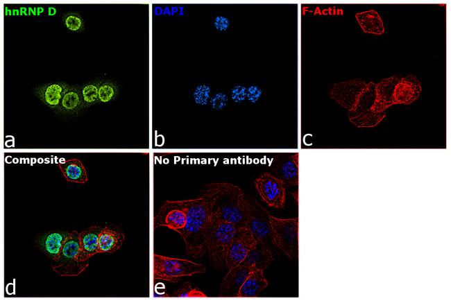 hnRNP D Antibody in Immunocytochemistry (ICC/IF)