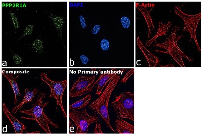 PPP2R1A Antibody in Immunocytochemistry (ICC/IF)