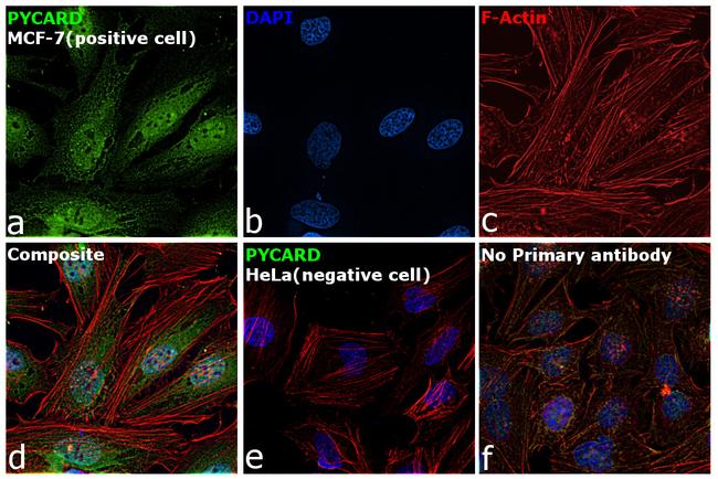 PYCARD Antibody in Immunocytochemistry (ICC/IF)