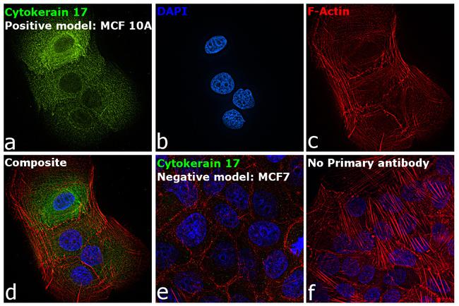 Cytokeratin 17 Antibody in Immunocytochemistry (ICC/IF)