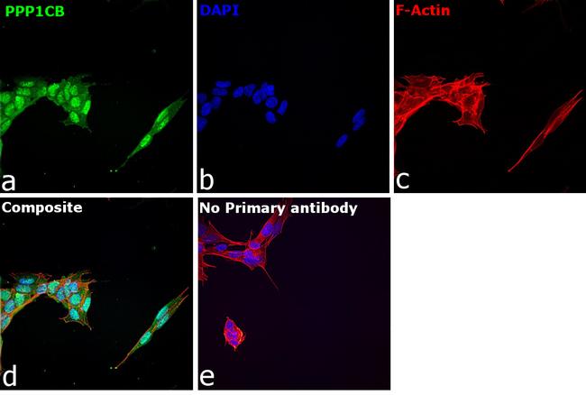 PP1 beta Antibody in Immunocytochemistry (ICC/IF)