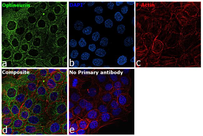 Optineurin Antibody in Immunocytochemistry (ICC/IF)