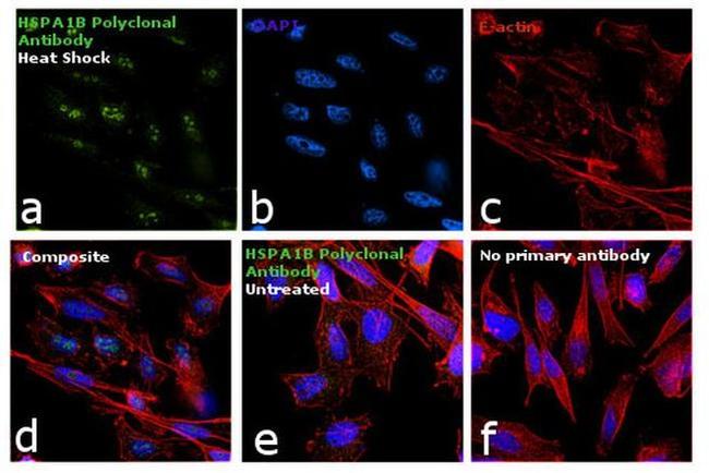 HSPA1B Antibody in Immunocytochemistry (ICC/IF)