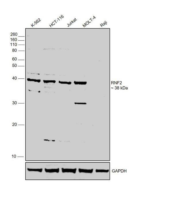 RNF2 Antibody in Western Blot (WB)