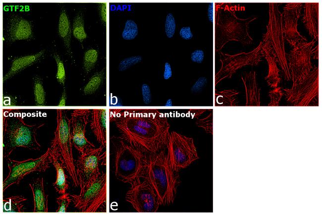 GTF2B Antibody in Immunocytochemistry (ICC/IF)