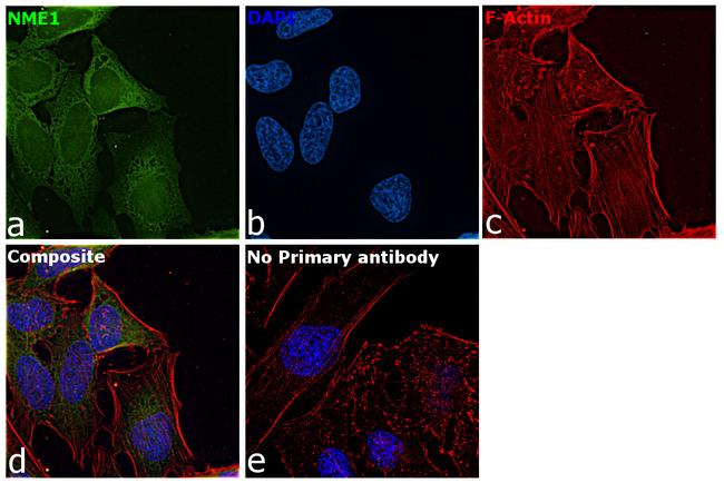 NME1 Antibody in Immunocytochemistry (ICC/IF)