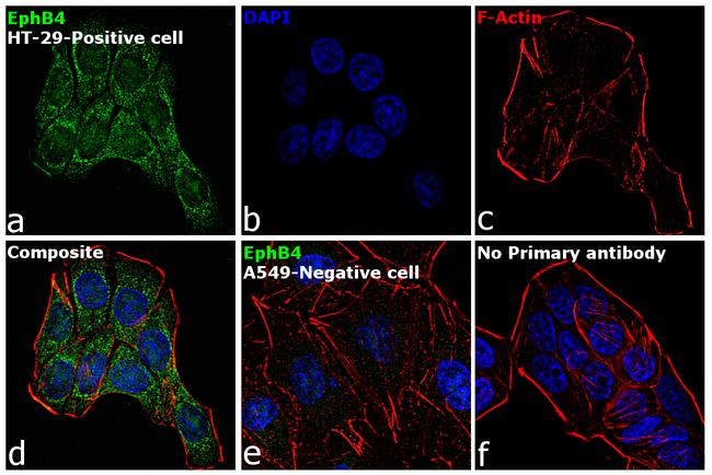 EphB4 Antibody in Immunocytochemistry (ICC/IF)