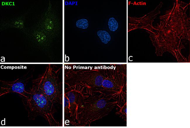 DKC1 Antibody in Immunocytochemistry (ICC/IF)