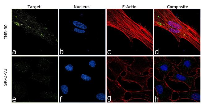 COL6A1 Antibody in Immunocytochemistry (ICC/IF)