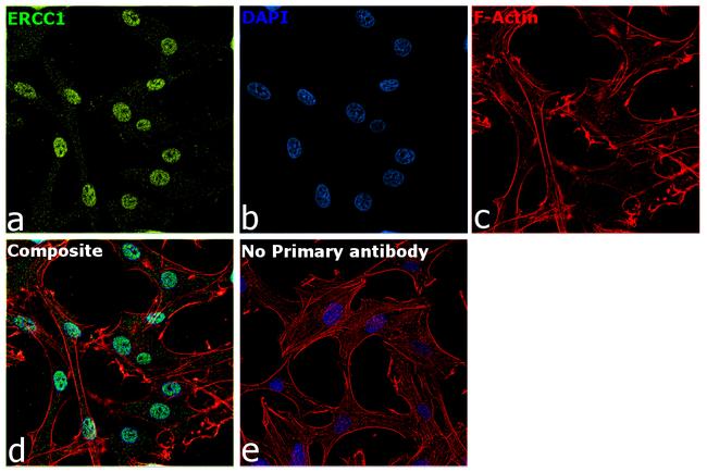 ERCC1 Antibody in Immunocytochemistry (ICC/IF)