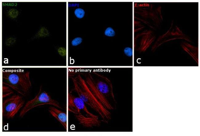 SMAD2 Antibody in Immunocytochemistry (ICC/IF)