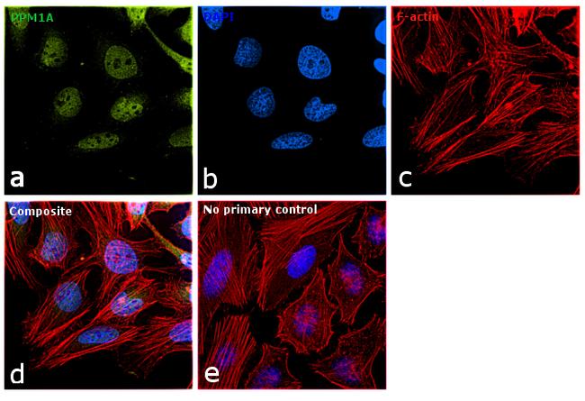 PPM1A Antibody in Immunocytochemistry (ICC/IF)