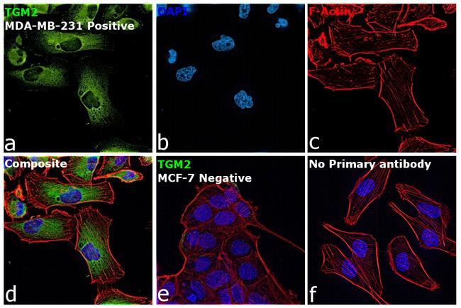 TGM2 Antibody in Immunocytochemistry (ICC/IF)