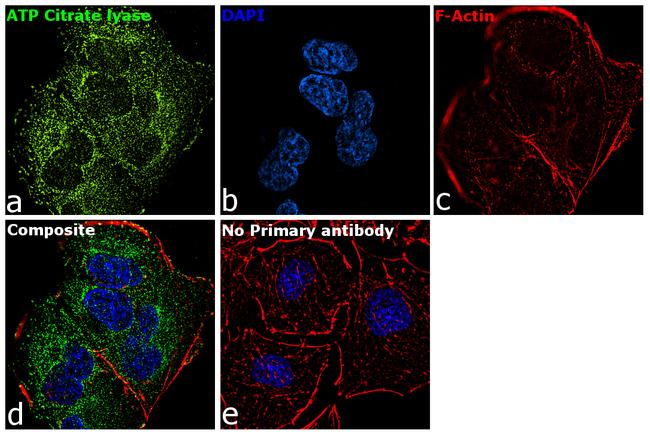 ATP Citrate Lyase Antibody in Immunocytochemistry (ICC/IF)