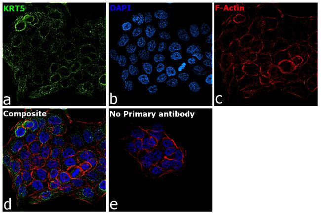 Cytokeratin 5 Antibody in Immunocytochemistry (ICC/IF)