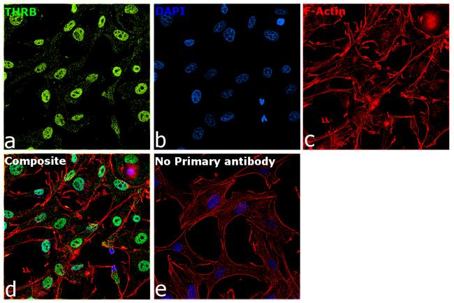 THRB Antibody in Immunocytochemistry (ICC/IF)