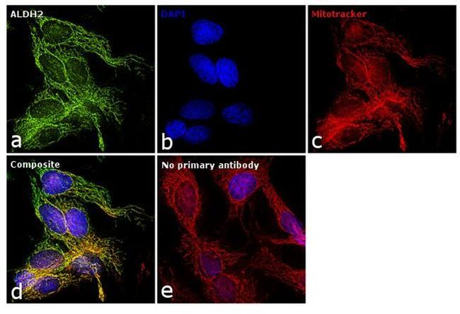 ALDH2 Antibody in Immunocytochemistry (ICC/IF)