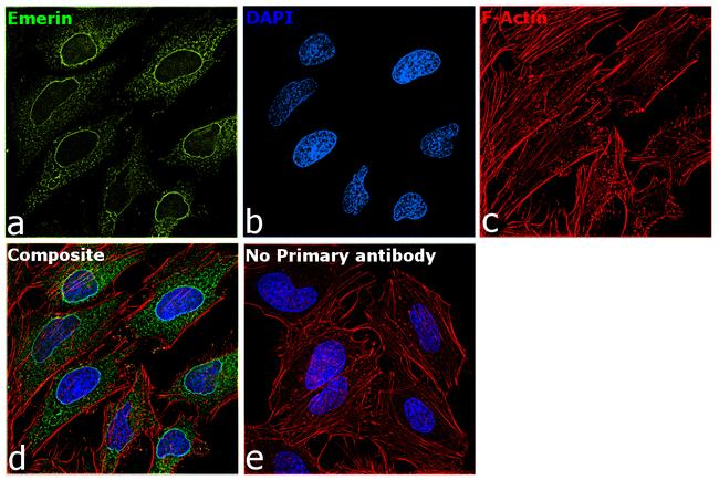 Emerin Antibody in Immunocytochemistry (ICC/IF)