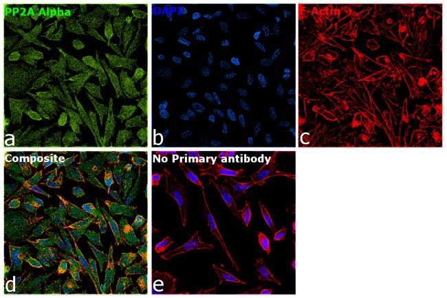 PP2A alpha Antibody in Immunocytochemistry (ICC/IF)