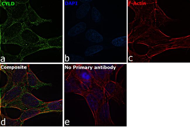 CYLD Antibody in Immunocytochemistry (ICC/IF)