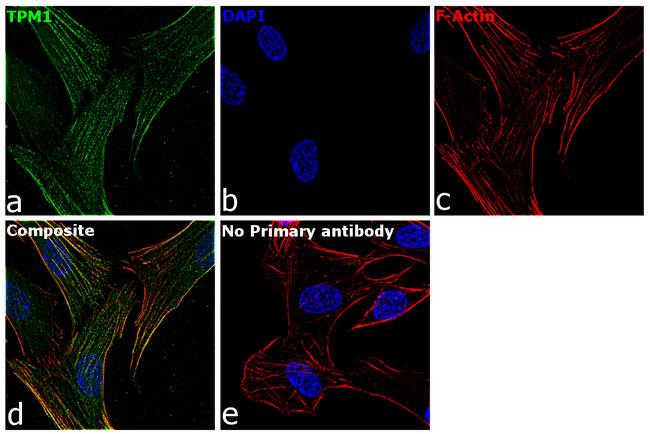 TPM1 Antibody in Immunocytochemistry (ICC/IF)