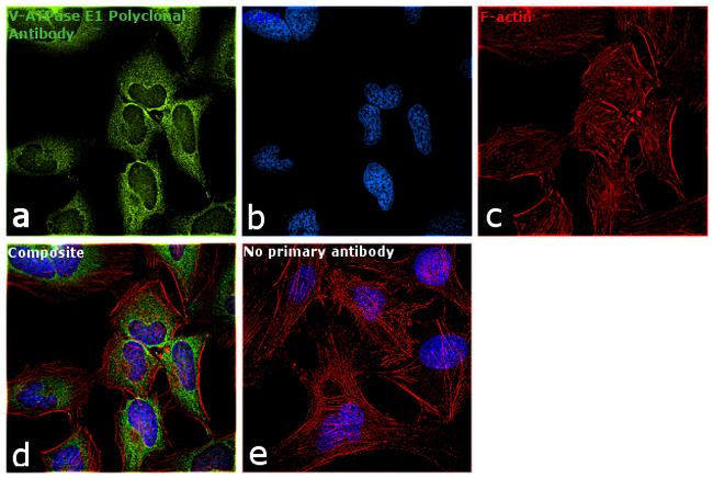 V-ATPase E1 Antibody in Immunocytochemistry (ICC/IF)