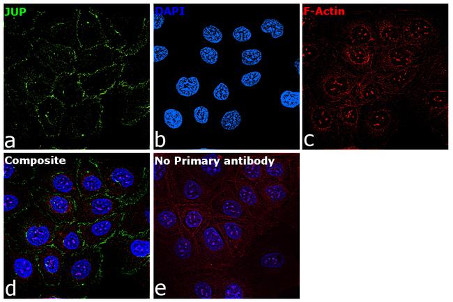 gamma Catenin Antibody in Immunocytochemistry (ICC/IF)