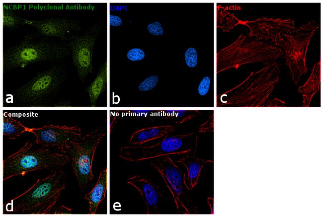 NCBP1 Antibody in Immunocytochemistry (ICC/IF)