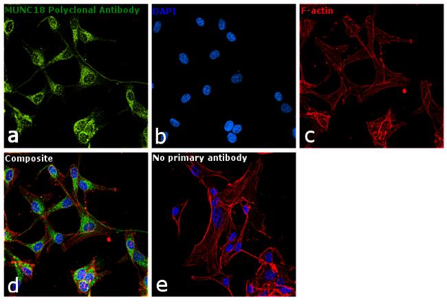 MUNC18 Antibody in Immunocytochemistry (ICC/IF)