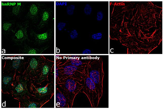 hnRNP M Antibody in Immunocytochemistry (ICC/IF)