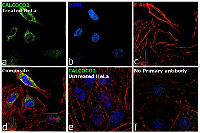 CALCOCO2 Antibody in Immunocytochemistry (ICC/IF)