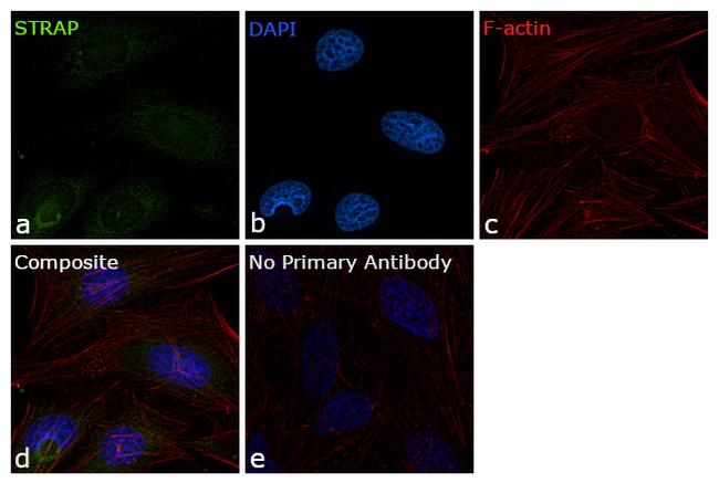 STRAP Antibody in Immunocytochemistry (ICC/IF)