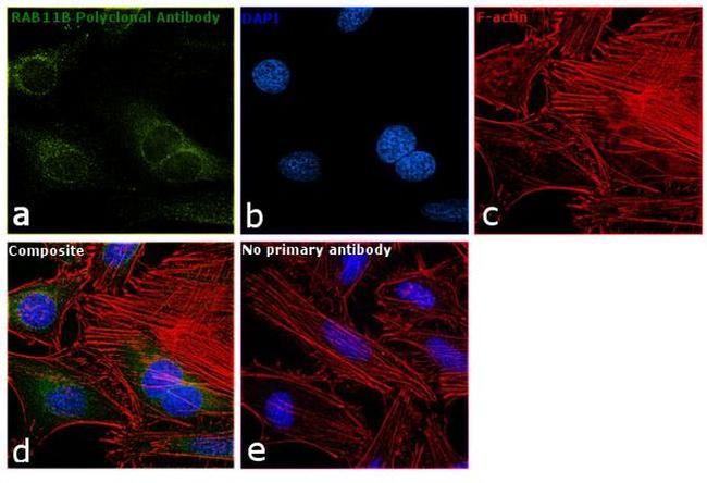 RAB11B Antibody in Immunocytochemistry (ICC/IF)