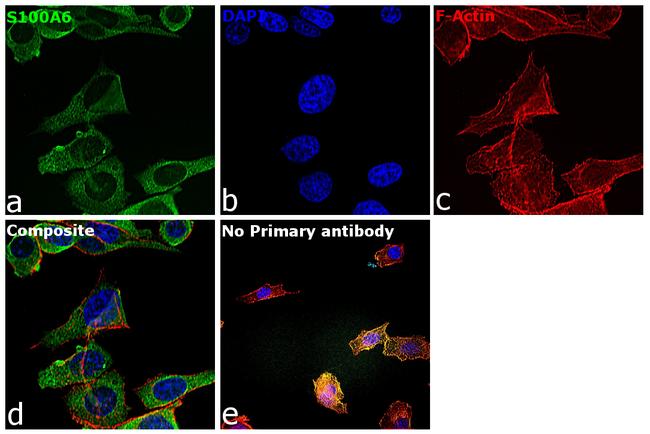 S100A6 Antibody in Immunocytochemistry (ICC/IF)