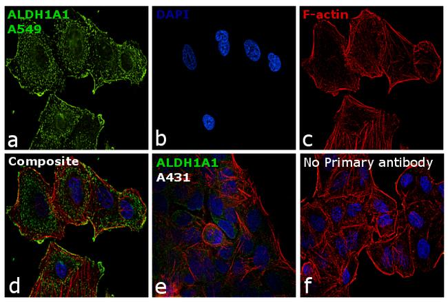 ALDH1A1 Antibody in Immunocytochemistry (ICC/IF)