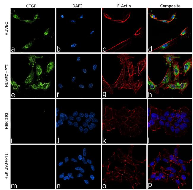 CTGF Antibody in Immunocytochemistry (ICC/IF)