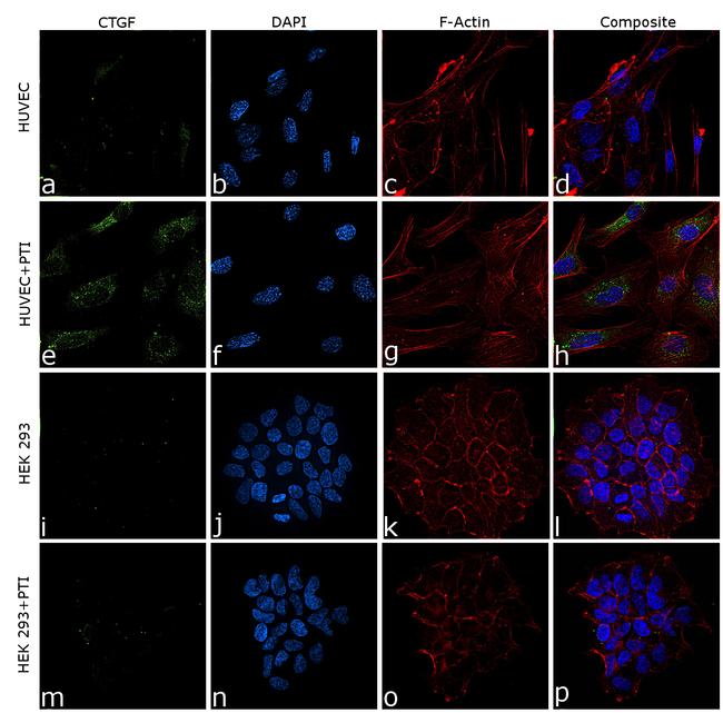 CTGF Antibody in Immunocytochemistry (ICC/IF)