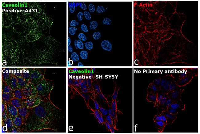 Caveolin 1 Antibody in Immunocytochemistry (ICC/IF)