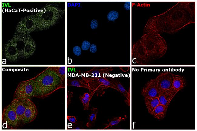 Involucrin Antibody in Immunocytochemistry (ICC/IF)