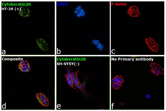 Cytokeratin 20 Antibody in Immunocytochemistry (ICC/IF)